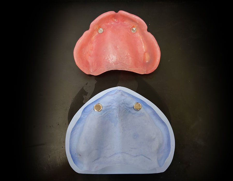 磁性アタッチメント